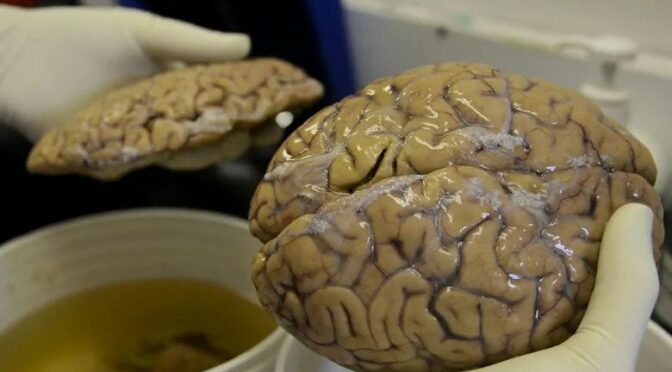 Brain dead: 2600-year-old perfectly preserved British brain found