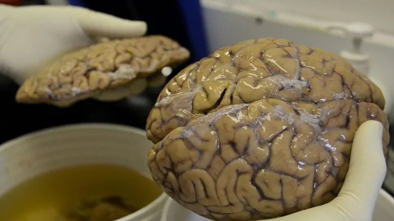 Brain dead: 2500-year-old perfectly preserved British brain found