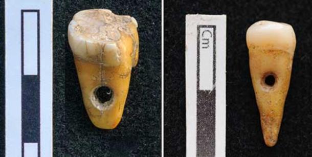 Human teeth made into pendants in Turkey 8,500 years ago