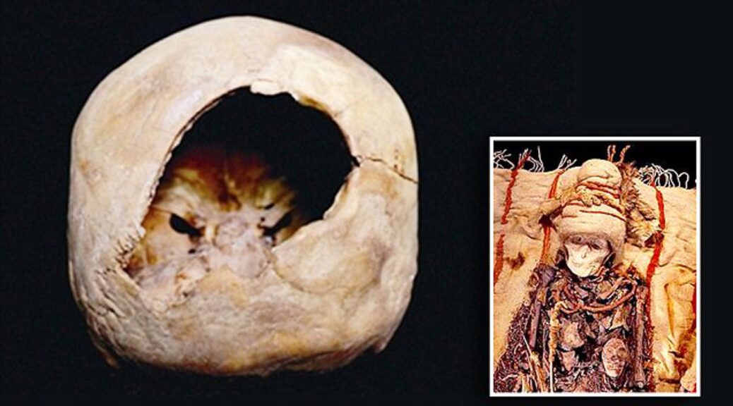 Chinese mummy suggests brain surgery was carried out 3,600 years ago