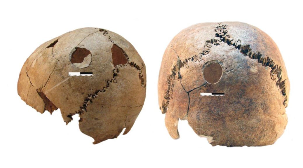 Why were dozens of people butchered 6,200 years ago and buried in a Neolithic death pit?