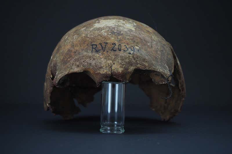 Earliest known bubonic plague strain found in a 5000-year-old skull