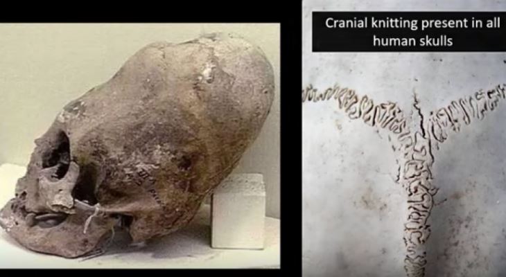 Prehistoric aliens in Malta? Hypogeum’s trove of elongated skulls to get cutting-edge study