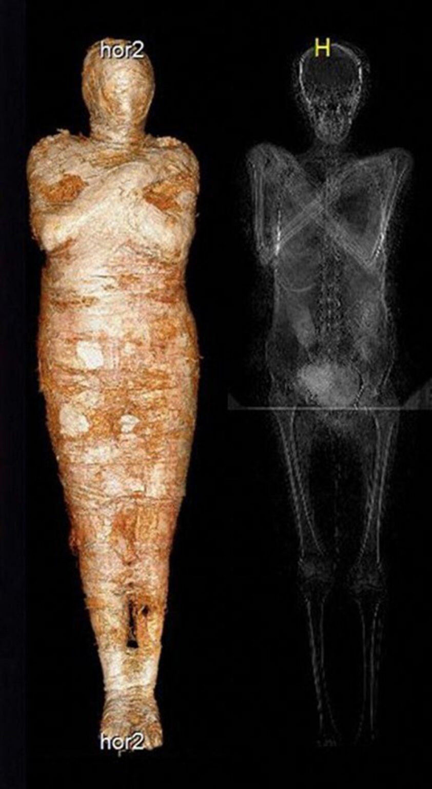 World’s First known case of a pregnant mummy discovered by researchers