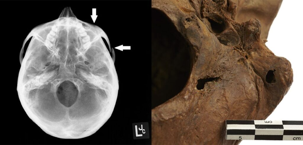 Skulls suggest Romans in London enjoyed human blood sports
