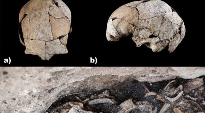 Evidence of Surgery Some 5,300 Years Ago Identified in Spain