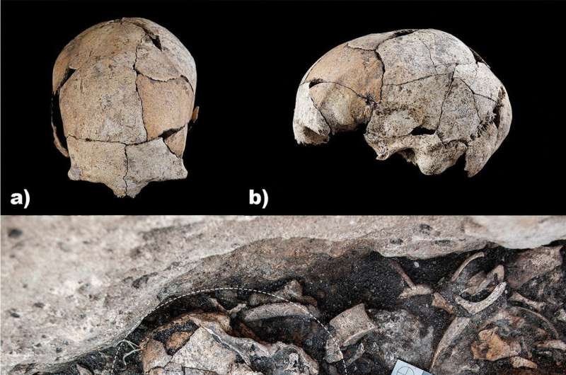 Evidence of Surgery Some 5,300 Years Ago Identified in Spain