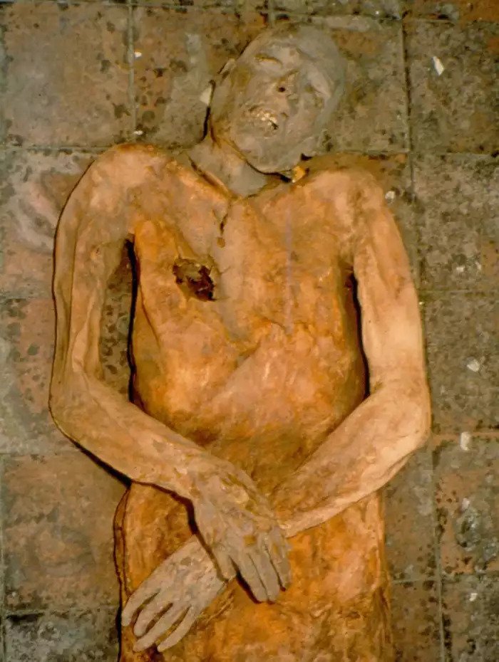 16th-Century E. coli Sample Extracted from Italian Mummy