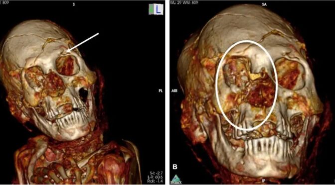 CT Scans Reveal Gnarly, 1,000-Year-Old Mummies Were Murdered