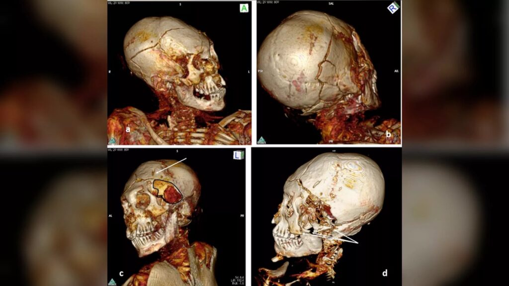 Компьютерная томография показала, что 1000-летние мумии были убиты