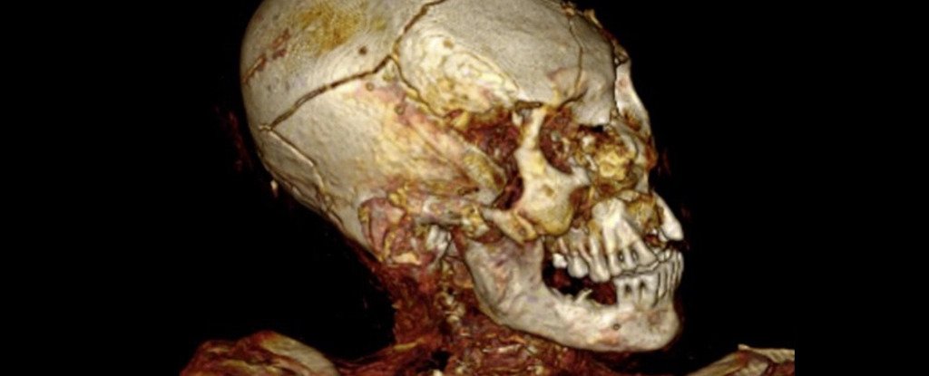 Южноамериканские мумии были зверски убиты, показало компьютерное сканирование