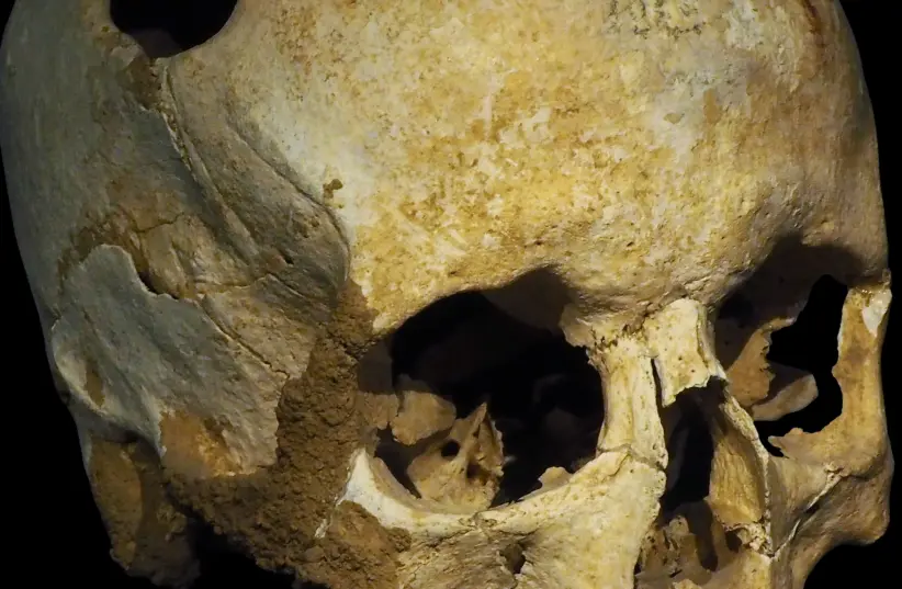Skull found in Turkey with neat hole may have been the work of mystics