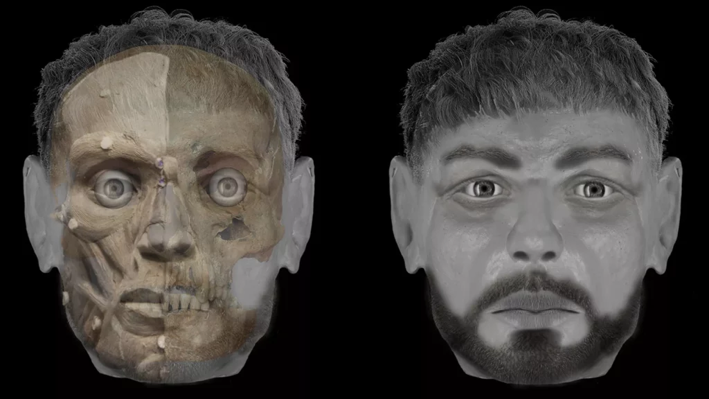 Head Wounds of Medieval Victim Analyzed