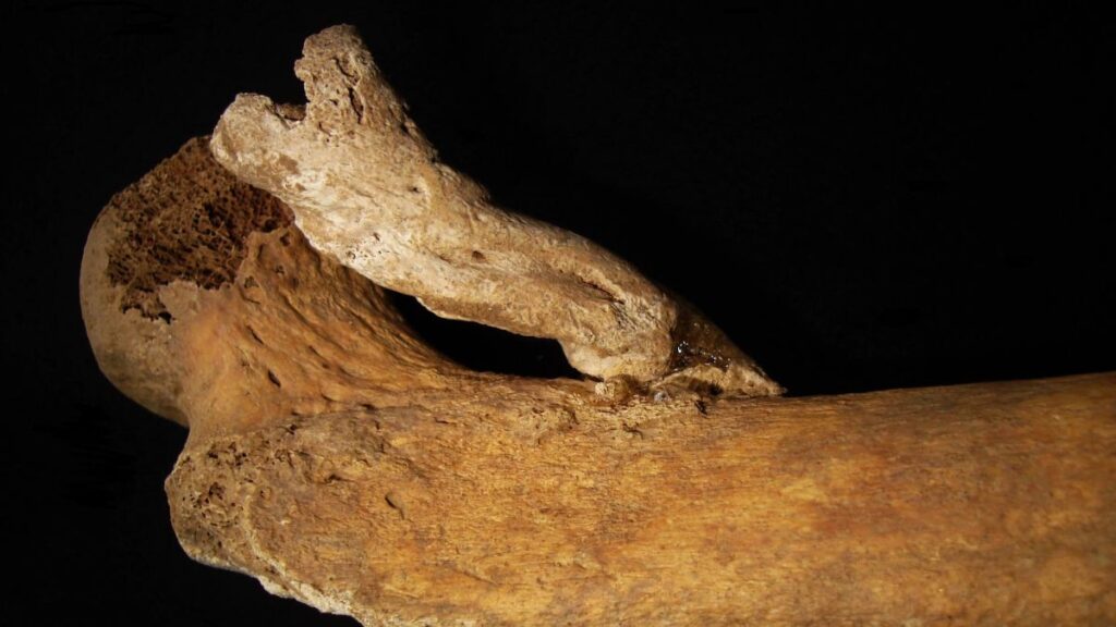 В Португалии обнаружен многовековой скелет с массивным, парализующим костным наростом