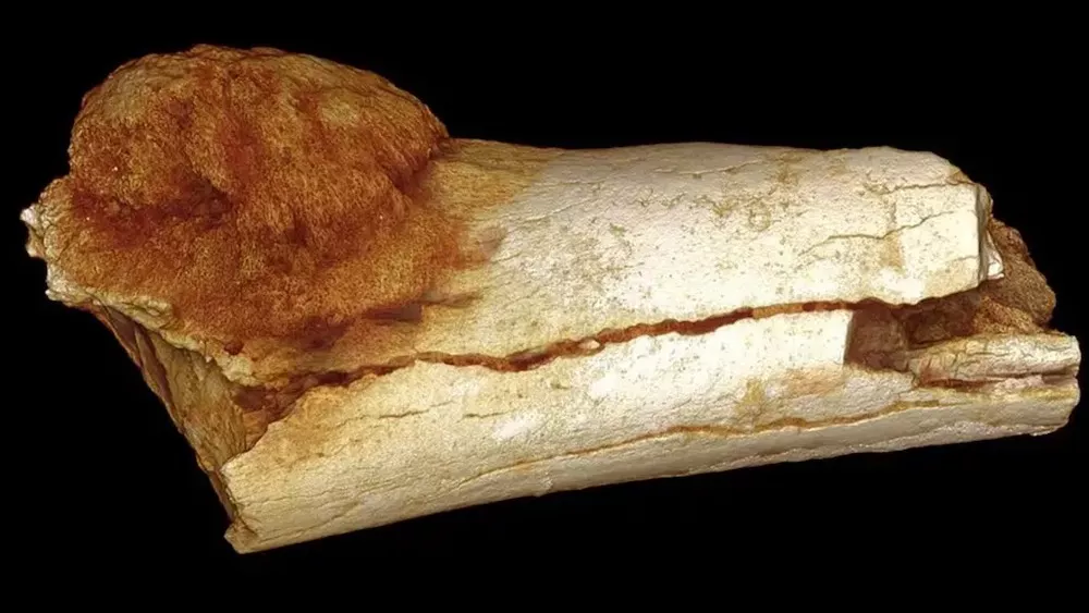 What's the oldest known case of cancer in humans?