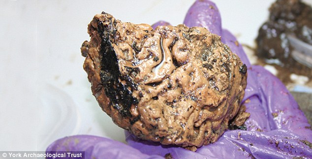 Scientists Discover Beheaded Man's Brain Self-Preserved For 2,600 Years