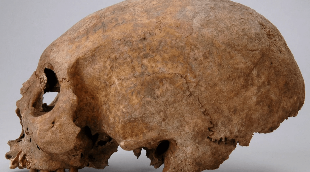 Three Strange Skull Modifications Discovered in Viking Women